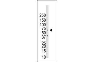 Western Blotting (WB) image for anti-Bone Morphogenetic Protein Receptor, Type IB (BMPR1B) (AA 1-30), (N-Term) antibody (ABIN388738)