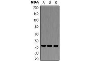 Western blot analysis of Alpha-actin-1 expression in Hela (A), NIH3T3 (B), rat kidney (C) whole cell lysates. (Actin Antikörper)