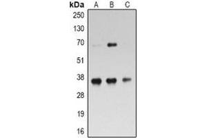 Western blot analysis of RPL5 expression in Hela (A), Jurkat (B), MOLT4 (C) whole cell lysates. (RPL5 Antikörper)