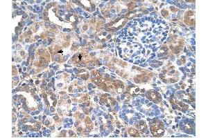 GALNT6 antibody was used for immunohistochemistry at a concentration of 4-8 ug/ml to stain Epithelial cells of renal tubule (arrows) in Human Kidney. (GALNT6 Antikörper  (N-Term))