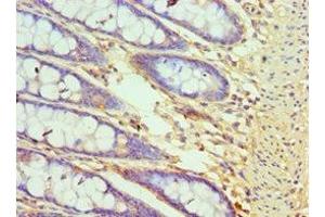 Immunohistochemistry of paraffin-embedded human colon tissue using ABIN7148781 at dilution of 1:100 (CXXC1 Antikörper  (AA 1-210))