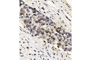 IHC analysis of FOXF1 using anti-FOXF1 antibody (ABIN7601744). (FOXF1 Antikörper  (AA 44-379))