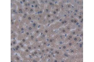 IHC-P analysis of liver tissue, with DAB staining. (DKC1 Antikörper  (AA 298-509))