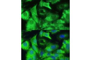 Immunofluorescence (IF) image for anti-Ezrin (EZR) (AA 350-470) antibody (ABIN6140400)