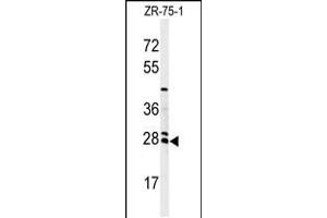 Western blot analysis of NAT8 Antibody in ZR-75-1 cell line lysates (35ug/lane) (NAT8 Antikörper  (AA 110-138))
