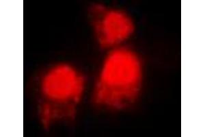 Immunofluorescent analysis of SIAH2 staining in MCF7 cells. (SIAH2 Antikörper  (C-Term))