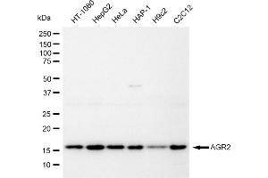 Western blotting analysis using AGR2 antibody (ABIN7797627).