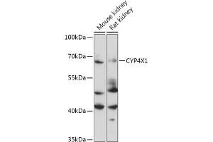 Western blot analysis of extracts of Mouse kidney, using CYP4X1 antibody (ABIN7266659) at 1:1000 dilution. (CYP4X1 Antikörper  (AA 190-290))