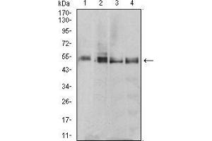Western blot analysis using *** mouse mAb against MCF-7 (1), T47D (2), MOLT4 (3), and Raji (4) cell lysate. (MTRF1 Antikörper  (AA 288-437))