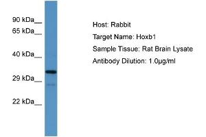 Host:  Rabbit  Target Name:  Hoxb1  Sample Type:  Rat Brain lysates  Antibody Dilution:  1. (HOXB1 Antikörper  (N-Term))