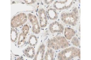 ABIN6266539 at 1/100 staining human kidney tissue sections by IHC-P. (FGFR2 Antikörper  (C-Term))