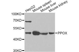 Western blot analysis of extracts of various cell lines, using PPOX Antibody (ABIN2564653) at 1:1000 dilution. (PPOX Antikörper)