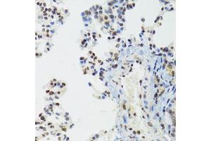 Immunohistochemistry of paraffin-embedded mouse lung using BAZ1B antibody (ABIN6003583) at dilution of 1/100 (40x lens). (BAZ1B Antikörper)