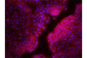 Immunofluorescence (IF) image for anti-Chemokine (C-X-C Motif) Receptor 4 (CXCR4) antibody (ABIN2664315) (CXCR4 Antikörper)