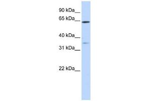 TRIM45 antibody used at 1 ug/ml to detect target protein. (TRIM45 Antikörper  (Middle Region))