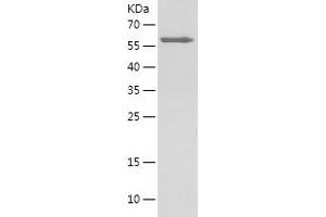 Western Blotting (WB) image for Annexin A1 (ANXA1) (AA 24-346) protein (His-IF2DI Tag) (ABIN7121843)