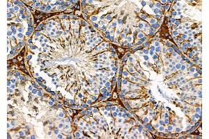 ABIN6254898 and ABIN6279150 at 1/100 staining Mouse testis tissue by IHC-P. (ATXN7L1 Antikörper  (N-Term))