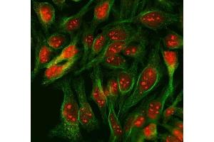 IF analysis of SCML1 using anti-SCML1 antibody (ABIN7602479) and anti-Tubulin Alpha antibody (ABIN7600339).