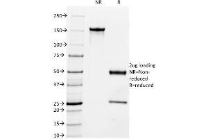 SDS-PAGE Analysis Purified Milk Fat Globule Monoclonal Antibody (MFG-06). (MFGE8 Antikörper)