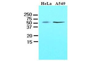 Western Blotting (WB) image for anti-Kruppel-Like Factor 4 (Gut) (KLF4) (AA 1-170), (N-Term) antibody (ABIN336104)