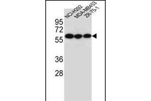 CHRNA10 Antibody (Center) (ABIN656120 and ABIN2845459) western blot analysis in NCI-,MDA-M,ZR-75-1 cell line lysates (35 μg/lane). (CHRNA10 Antikörper  (AA 179-206))