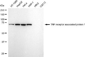 Western blotting analysis using TNF receptor associated protein 1 antibody (ABIN7800567). (Rekombinanter TRAP1 Antikörper)