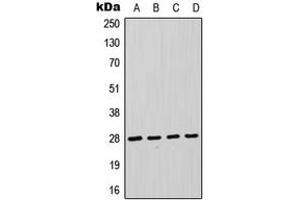 Western blot analysis of FADD expression in HeLa (A), Jurkat (B), THP1 (C), A431 (D) whole cell lysates. (FADD Antikörper  (Center))