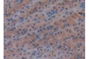 Immunohistochemistry (IHC) image for anti-Laminin, alpha 1 (LAMA1) (AA 1156-1276) antibody (ABIN7444121)