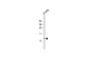 Anti-RIG Antibody (C-Term) at 1:1000 dilution + human lung lysate Lysates/proteins at 20 μg per lane. (DIRAS1 Antikörper  (AA 58-87))
