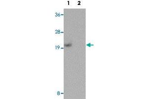 Western blot analysis of human kidney tissue with PIAS1 polyclonal antibody  at 1 ug/mL in (Lane 1) the absence and (Lane 2) the presence of blocking peptide. (PIAS1 Antikörper  (C-Term))
