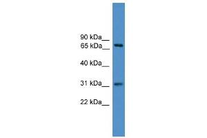 WB Suggested Anti-ZNF471 Antibody Titration:  0. (ZNF471 Antikörper  (N-Term))