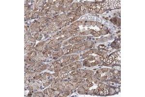 Immunohistochemical staining of human stomach with LRCH4 polyclonal antibody  shows moderate cytoplasmic and membranous positivity in glandular cells. (LRCH4 Antikörper)