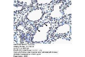 Human Lung (MYEF2 Antikörper  (Middle Region))