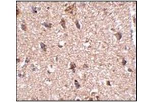 Immunohistochemistry of JPH3 in human brain tissue with this product at 2. (Junctophilin 3 Antikörper  (Center))