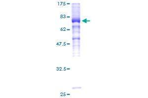 Image no. 1 for Single Immunoglobulin and Toll-Interleukin 1 Receptor (TIR) Domain (SIGIRR) (AA 1-410) protein (GST tag) (ABIN1319981) (SIGIRR Protein (AA 1-410) (GST tag))