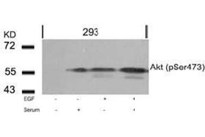 Image no. 2 for anti-V-Akt Murine Thymoma Viral Oncogene Homolog 1 (AKT1) (pSer473) antibody (ABIN196708) (AKT1 Antikörper  (pSer473))