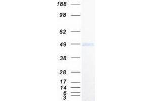 Western Blotting (WB) image for Inhibitor of KB Kinase beta Interacting Protein (IKbIP) (Transcript Variant 1) protein (Myc-DYKDDDDK Tag) (ABIN2723362)