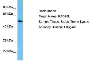 Host: Rabbit Target Name: RAD26L Sample Type: Breast Tumor lysates Antibody Dilution: 1. (ERCC6L2 Antikörper  (N-Term))