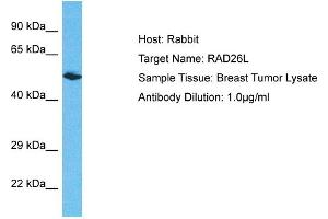 Western Blotting (WB) image for anti-Excision Repair Cross-Complementing Rodent Repair Deficiency, Complementation Group 6-Like 2 (ERCC6L2) (N-Term) antibody (ABIN2785695)