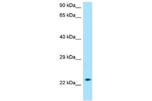 WB Suggested Anti-SLC50A1 AntibodyTitration: 1. (SLC50A1 Antikörper  (C-Term))