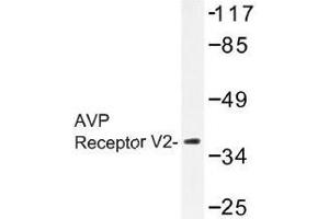 Image no. 1 for anti-Arginine Vasopressin Receptor 2 (AVPR2) antibody (ABIN317870)