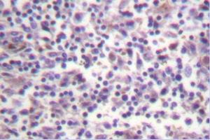 Image no. 1 for anti-B-Raf proto-oncogene, serine/threonine kinase (BRAF) antibody (ABIN271999) (BRAF Antikörper)