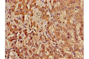 Immunohistochemistry of paraffin-embedded human liver tissue using ABIN7158499 at dilution of 1:100 (ACADL Antikörper  (AA 30-260))