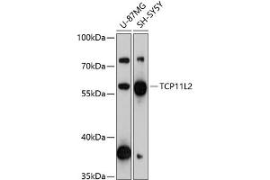 Western blot analysis of extracts of various cell lines, using TCP11L2 antibody (ABIN6133204, ABIN6148958, ABIN6148959 and ABIN6217166) at 1:3000 dilution. (TCP11L2 Antikörper  (AA 1-340))