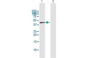 Western Blotting (WB) image for anti-Tumor Necrosis Factor Receptor Superfamily, Member 10b (TNFRSF10B) (AA 1-440) antibody (ABIN522238)