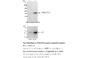Western Blotting (WB) image for anti-Tumor Protein P53 (TP53) (pSer315) antibody (ABIN3201006) (p53 Antikörper  (pSer315))