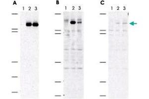 Immunoblot of MAP3K5 (phospho S83) polyclonal antibody  shows specificity for phosphorylated human MAP3K5. (ASK1 Antikörper  (pSer83))