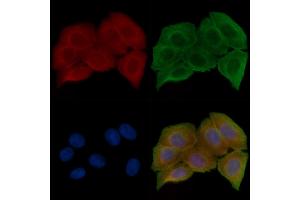 ABIN6257699 and ABIN6274595 staining Hela cells(30 min of UV treatment) by IF/ICC.