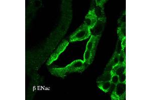 Immunohistochemistry analysis using Rabbit Anti-ENaC Polyclonal Antibody . (SCNN1A Antikörper  (AA 617-638) (HRP))