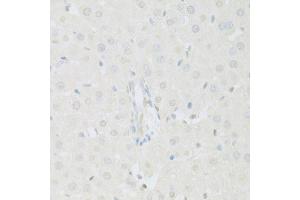 Immunohistochemistry of paraffin-embedded rat liver using KAT2A antibody (ABIN5971244) at dilution of 1/100 (40x lens). (KAT2A Antikörper)